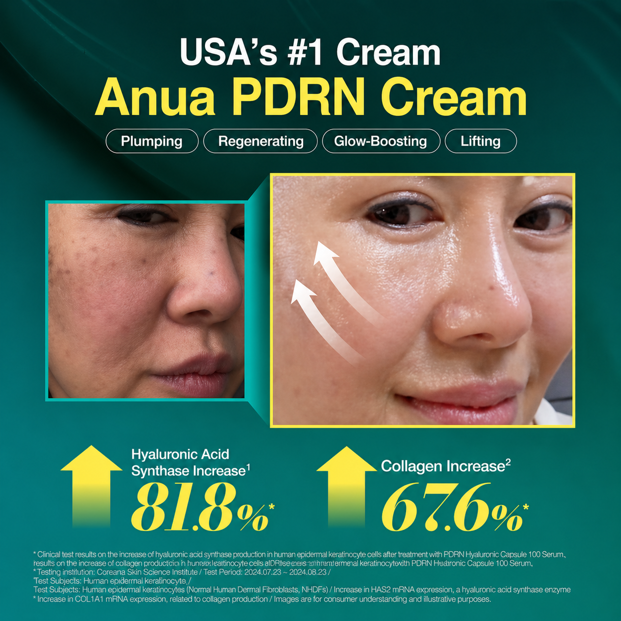 PDRN Hyaluronic Acid 100 Moisturizing Cream